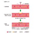 画像2: ギミック クイックストップ90g ■ネコポス対象外■ (2)