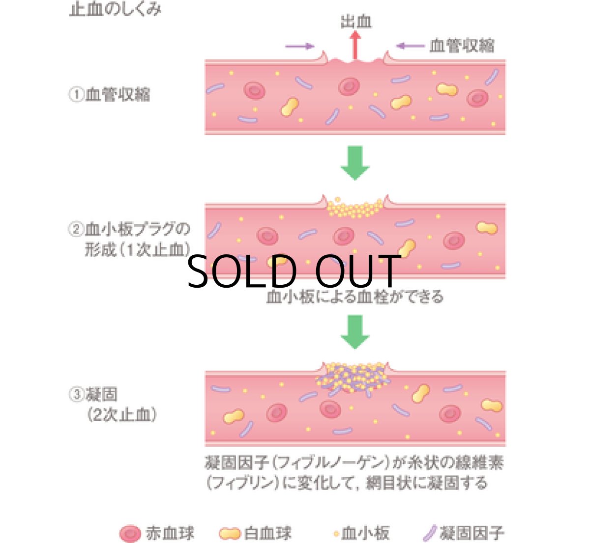 画像2: ギミック クイックストップ90g ■ネコポス対象外■ (2)