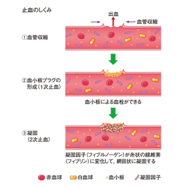 画像2: ギミック クイックストップ90g ■ネコポス対象外■