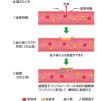 画像2: ギミック クイックストップ90g ■ネコポス対象外■ (2)