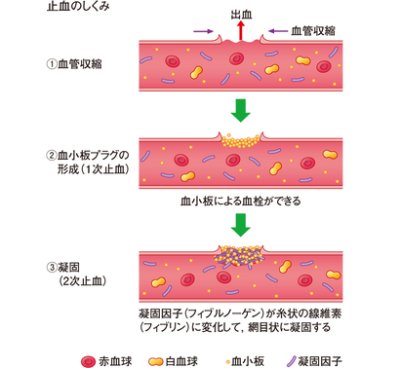 画像1: ギミック クイックストップ90g ■ネコポス対象外■